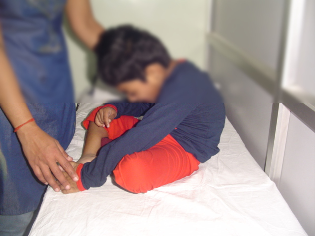 Cerebral Palsy Symptoms